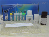 绵羊白介素2受体检测试剂盒,IL-2R试剂盒